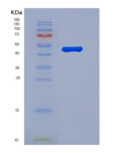 SDS-PAGE analysis of Human NPR3 (Atrial Natriuretic Peptide Receptor 3) - Recombinant Protein, showing >90% purity under 15% SDS-PAGE (Reduced)