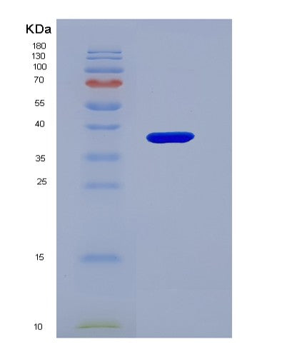 SDS-PAGE analysis of Human CD1D (Antigen-Presenting Glycoprotein Cd1D) - Recombinant Protein, showing >90% purity under 15% SDS-PAGE (Reduced)
