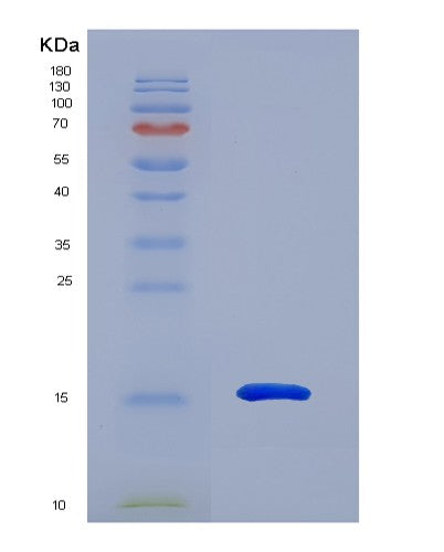 SDS-PAGE analysis of Human MGP (Matrix Gla Protein) - Recombinant Protein, showing >90% purity under 15% SDS-PAGE (Reduced)