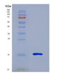 SDS-PAGE analysis of Human MGP (Matrix Gla Protein) - Recombinant Protein, showing >90% purity under 15% SDS-PAGE (Reduced)