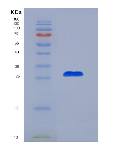SDS-PAGE analysis of Mouse Il6 (Interleukin-6) - Recombinant Protein, showing >85% purity under 15% SDS-PAGE (Reduced)