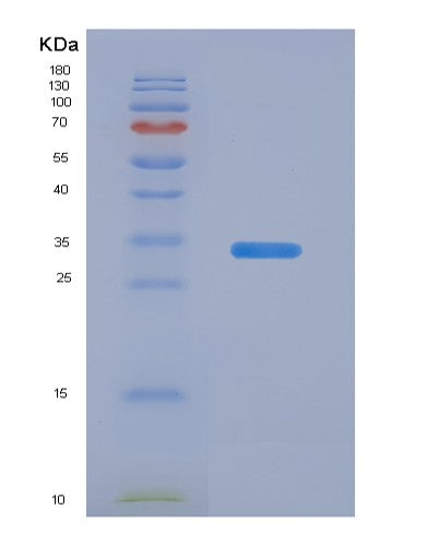 SDS-PAGE analysis of Human ANXA5 (Annexin A5) - Recombinant Protein, showing >90% purity under 15% SDS-PAGE (Reduced)
