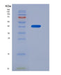 SDS-PAGE analysis of Human NMB (Neuromedin-B) - Recombinant Protein, showing >90% purity under 15% SDS-PAGE (Reduced)