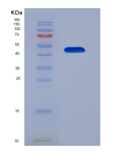 SDS-PAGE analysis of Human ENO2 (Gamma-Enolase) - Recombinant Protein, showing >85% purity under 15% SDS-PAGE (Reduced)