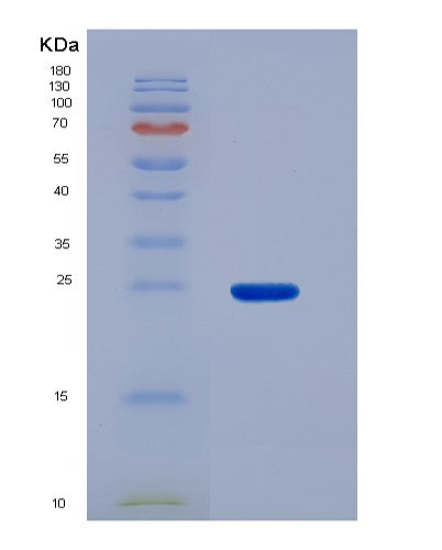 SDS-PAGE analysis of Human SDHB (Succinate Dehydrogenase [Ubiquinone] Iron-Sulfur Subunit, Mitochondrial) - Recombinant Protein, showing >90% purity under 15% SDS-PAGE (Reduced)