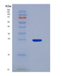 SDS-PAGE analysis of Human SDHB (Succinate Dehydrogenase [Ubiquinone] Iron-Sulfur Subunit, Mitochondrial) - Recombinant Protein, showing >90% purity under 15% SDS-PAGE (Reduced)