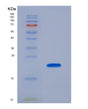SDS-PAGE analysis of Human NOX4 (Nadph Oxidase 4) - Recombinant Protein, showing >90% purity under 15% SDS-PAGE (Reduced)