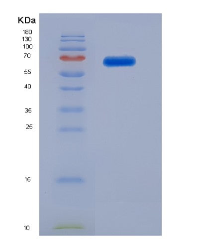 SDS-PAGE analysis of Human VTN (Vitronectin) - Recombinant Protein, showing >90% purity under 15% SDS-PAGE (Reduced)
