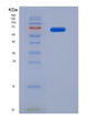 SDS-PAGE analysis of Human VTN (Vitronectin) - Recombinant Protein, showing >90% purity under 15% SDS-PAGE (Reduced)