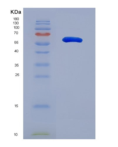 SDS-PAGE analysis of Human SLC26A7 (Anion Exchange Transporter) - Recombinant Protein, showing >90% purity under 15% SDS-PAGE (Reduced)