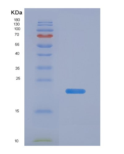 SDS-PAGE analysis of Mouse Nos2 (Nitric Oxide Synthase, Inducible) - Recombinant Protein, showing >90% purity under 15% SDS-PAGE (Reduced)