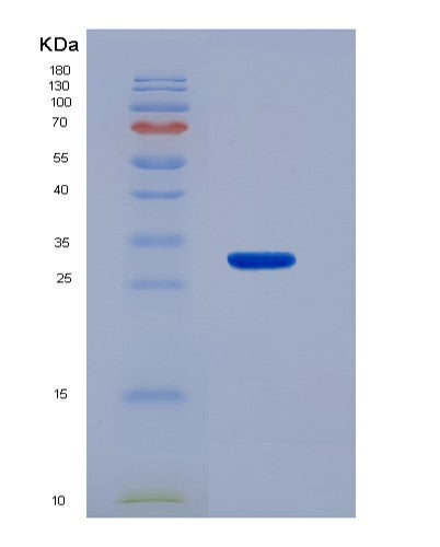 SDS-PAGE analysis of Human ACAA1 (3-Ketoacyl-Coa Thiolase, Peroxisomal) - Recombinant Protein, showing >95% purity under 15% SDS-PAGE (Reduced)