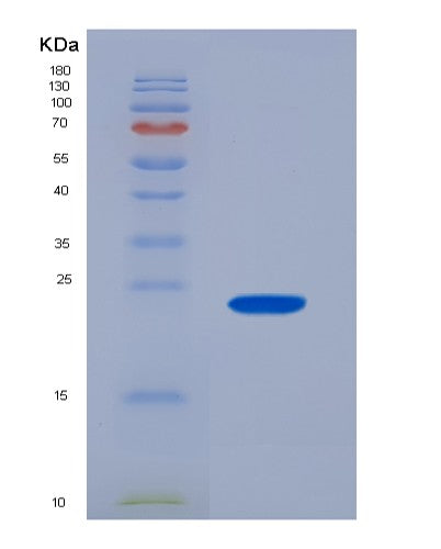 SDS-PAGE analysis of Human SNRPC (U1 Small Nuclear Ribonucleoprotein C) - Recombinant Protein, showing >95% purity under 15% SDS-PAGE (Reduced)