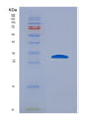 SDS-PAGE analysis of Human MMP7 (Matrilysin) - Recombinant Protein, showing >90% purity under 15% SDS-PAGE (Reduced)