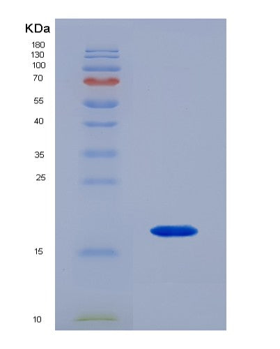SDS-PAGE analysis of Human RBP1 (Retinol-Binding Protein 1) - Recombinant Protein, showing >85% purity under 15% SDS-PAGE (Reduced)