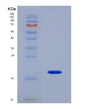 SDS-PAGE analysis of Human RBP1 (Retinol-Binding Protein 1) - Recombinant Protein, showing >85% purity under 15% SDS-PAGE (Reduced)