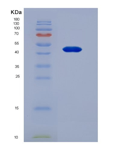 SDS-PAGE analysis of Human PAEP (Glycodelin) - Recombinant Protein, showing >90% purity under 15% SDS-PAGE (Reduced)