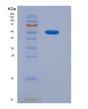 SDS-PAGE analysis of Human CLTA (Clathrin Light Chain A) - Recombinant Protein, showing >90% purity under 15% SDS-PAGE (Reduced)