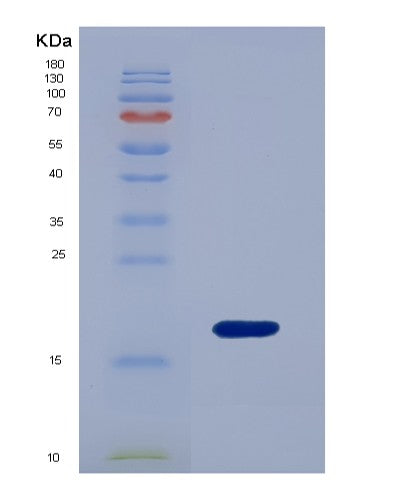 SDS-PAGE analysis of Human ANXA4 (Annexin A4) - Recombinant Protein, showing >85% purity under 15% SDS-PAGE (Reduced)