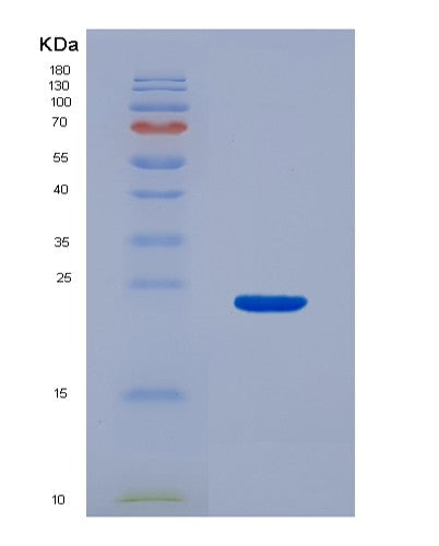 SDS-PAGE analysis of Human HMOX1 (Heme Oxygenase 1) - Recombinant Protein, showing >90% purity under 15% SDS-PAGE (Reduced)