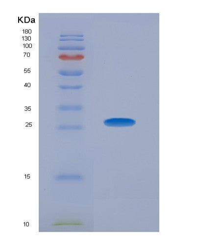 SDS-PAGE analysis of Human ITGA2 (Integrin Alpha-2) - Recombinant Protein, showing >90% purity under 15% SDS-PAGE (Reduced)