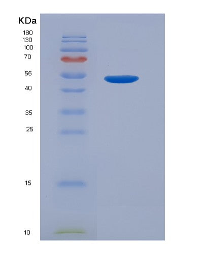 SDS-PAGE analysis of Human CRBN (Protein Cereblon) - Recombinant Protein, showing >90% purity under 15% SDS-PAGE (Reduced)