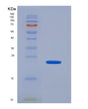 SDS-PAGE analysis of Mouse Sod2 (Superoxide Dismutase [Mn], Mitochondrial) - Recombinant Protein, showing >90% purity under 15% SDS-PAGE (Reduced)