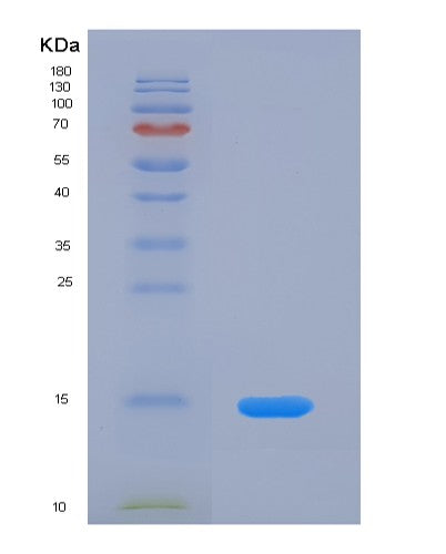 SDS-PAGE analysis of Human FURIN (Furin) - Recombinant Protein, showing >95% purity under 15% SDS-PAGE (Reduced)