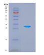 SDS-PAGE analysis of Human ALDOC (Fructose-Bisphosphate Aldolase C) - Recombinant Protein, showing >95% purity under 15% SDS-PAGE (Reduced)