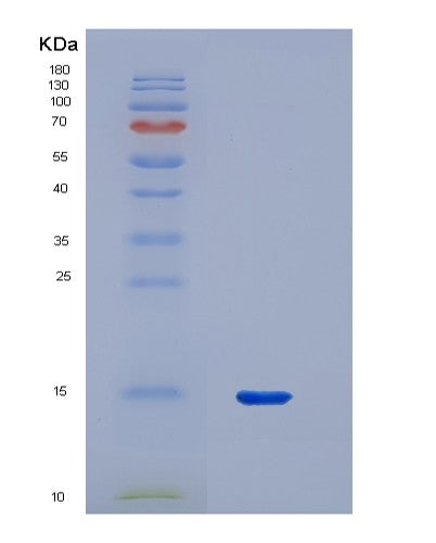 SDS-PAGE analysis of Human PPARG (Peroxisome Proliferator-Activated Receptor Gamma) - Recombinant Protein, showing >90% purity under 15% SDS-PAGE (Reduced)
