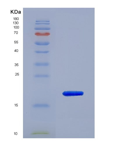 SDS-PAGE analysis of Human NOS2 (Nitric Oxide Synthase, Inducible) - Recombinant Protein, showing >90% purity under 15% SDS-PAGE (Reduced)