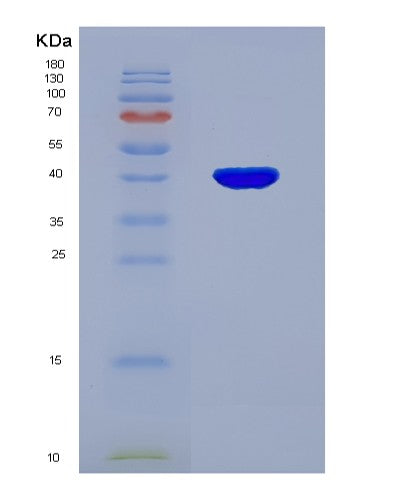 SDS-PAGE analysis of Human MAPK1 (Mitogen-Activated Protein Kinase 1) - Recombinant Protein, showing >90% purity under 15% SDS-PAGE (Reduced)