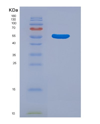 SDS-PAGE analysis of Human ALDH1A1 (Aldehyde Dehydrogenase 1A1) - Recombinant Protein, showing >90% purity under 15% SDS-PAGE (Reduced)