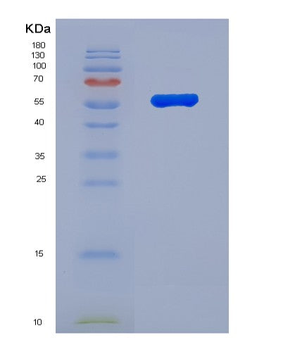 SDS-PAGE analysis of Human FLG (Filaggrin) - Recombinant Protein, showing >90% purity under 15% SDS-PAGE (Reduced)