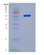 SDS-PAGE analysis of Human FLG (Filaggrin) - Recombinant Protein, showing >90% purity under 15% SDS-PAGE (Reduced)
