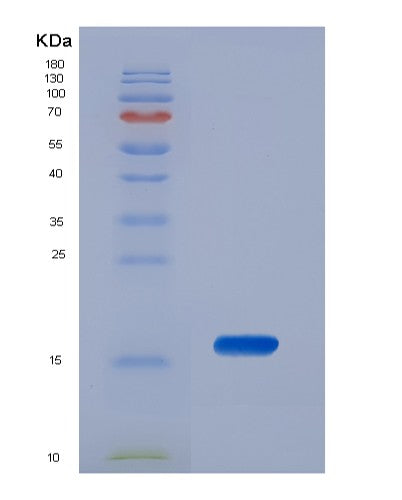 SDS-PAGE analysis of Human TRAPPC2 (Trafficking Protein Particle Complex Subunit 2) - Recombinant Protein, showing >85% purity under 15% SDS-PAGE (Reduced)