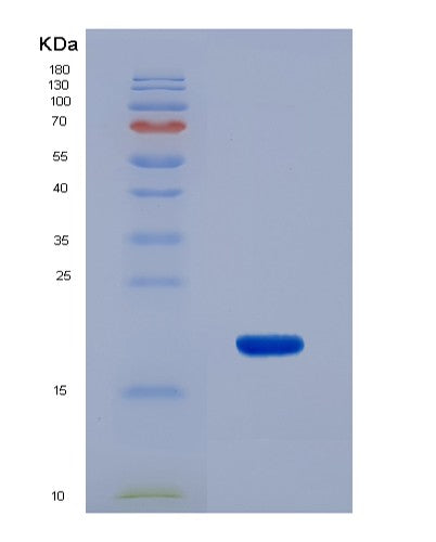 SDS-PAGE analysis of Human CALCB (Calcitonin Gene-Related Peptide 2) - Recombinant Protein, showing >95% purity under 15% SDS-PAGE (Reduced)