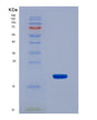 SDS-PAGE analysis of Human CALCB (Calcitonin Gene-Related Peptide 2) - Recombinant Protein, showing >95% purity under 15% SDS-PAGE (Reduced)