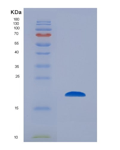 SDS-PAGE analysis of Mouse Ccl2 (C-C Motif Chemokine 2) - Recombinant Protein, showing >85% purity under 15% SDS-PAGE (Reduced)