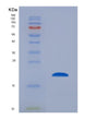 SDS-PAGE analysis of Mouse Ccl2 (C-C Motif Chemokine 2) - Recombinant Protein, showing >85% purity under 15% SDS-PAGE (Reduced)