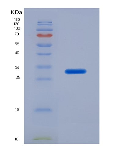 SDS-PAGE analysis of Human HLA-C (Hla Class I Histocompatibility Antigen, C Alpha Chain) - Recombinant Protein, showing >95% purity under 15% SDS-PAGE (Reduced)