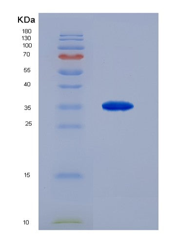 SDS-PAGE analysis of Human ROS1 (Proto-Oncogene Tyrosine-Protein Kinase Ros) - Recombinant Protein, showing >90% purity under 15% SDS-PAGE (Reduced)