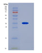 SDS-PAGE analysis of Human ROS1 (Proto-Oncogene Tyrosine-Protein Kinase Ros) - Recombinant Protein, showing >90% purity under 15% SDS-PAGE (Reduced)