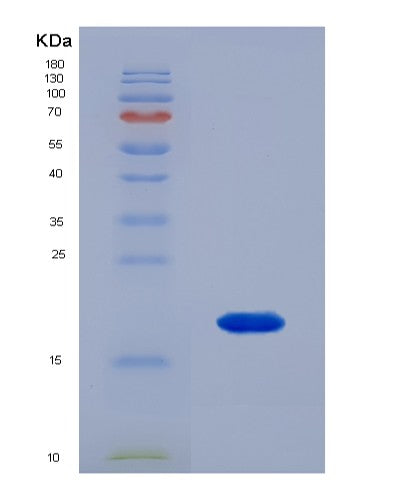 SDS-PAGE analysis of Human RNASE4 (Ribonuclease 4) - Recombinant Protein, showing >90% purity under 15% SDS-PAGE (Reduced)