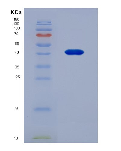SDS-PAGE analysis of Human TNFRSF11A (Tumor Necrosis Factor Receptor Superfamily Member 11A) - Recombinant Protein, showing >90% purity under 15% SDS-PAGE (Reduced)