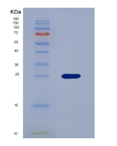 SDS-PAGE analysis of Human YBX1 (Y-Box-Binding Protein 1) - Recombinant Protein, showing >90% purity under 15% SDS-PAGE (Reduced)