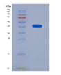 SDS-PAGE analysis of Human PF4V1 (Platelet Factor 4 Variant) - Recombinant Protein, showing >95% purity under 15% SDS-PAGE (Reduced)