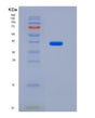 SDS-PAGE analysis of Human P4HA3 (Prolyl 4-Hydroxylase Subunit Alpha-3) - Recombinant Protein, showing >90% purity under 15% SDS-PAGE (Reduced)