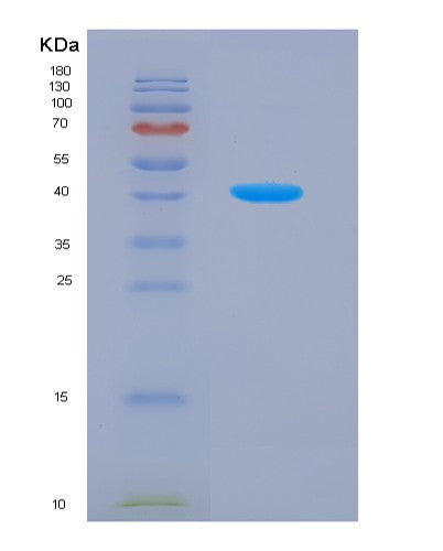 SDS-PAGE analysis of Human P4HA2 (Prolyl 4-Hydroxylase Subunit Alpha-2) - Recombinant Protein, showing >90% purity under 15% SDS-PAGE (Reduced)
