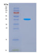SDS-PAGE analysis of Human P4HA2 (Prolyl 4-Hydroxylase Subunit Alpha-2) - Recombinant Protein, showing >90% purity under 15% SDS-PAGE (Reduced)